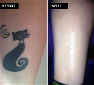 Smearproof &amp; Waterproof Tattoo, Bruise &amp; Scar Cover-Up
